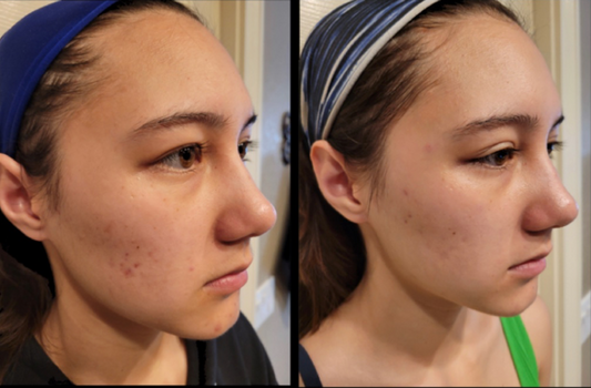 Ampoules that Amplify Skin Rejuvenation